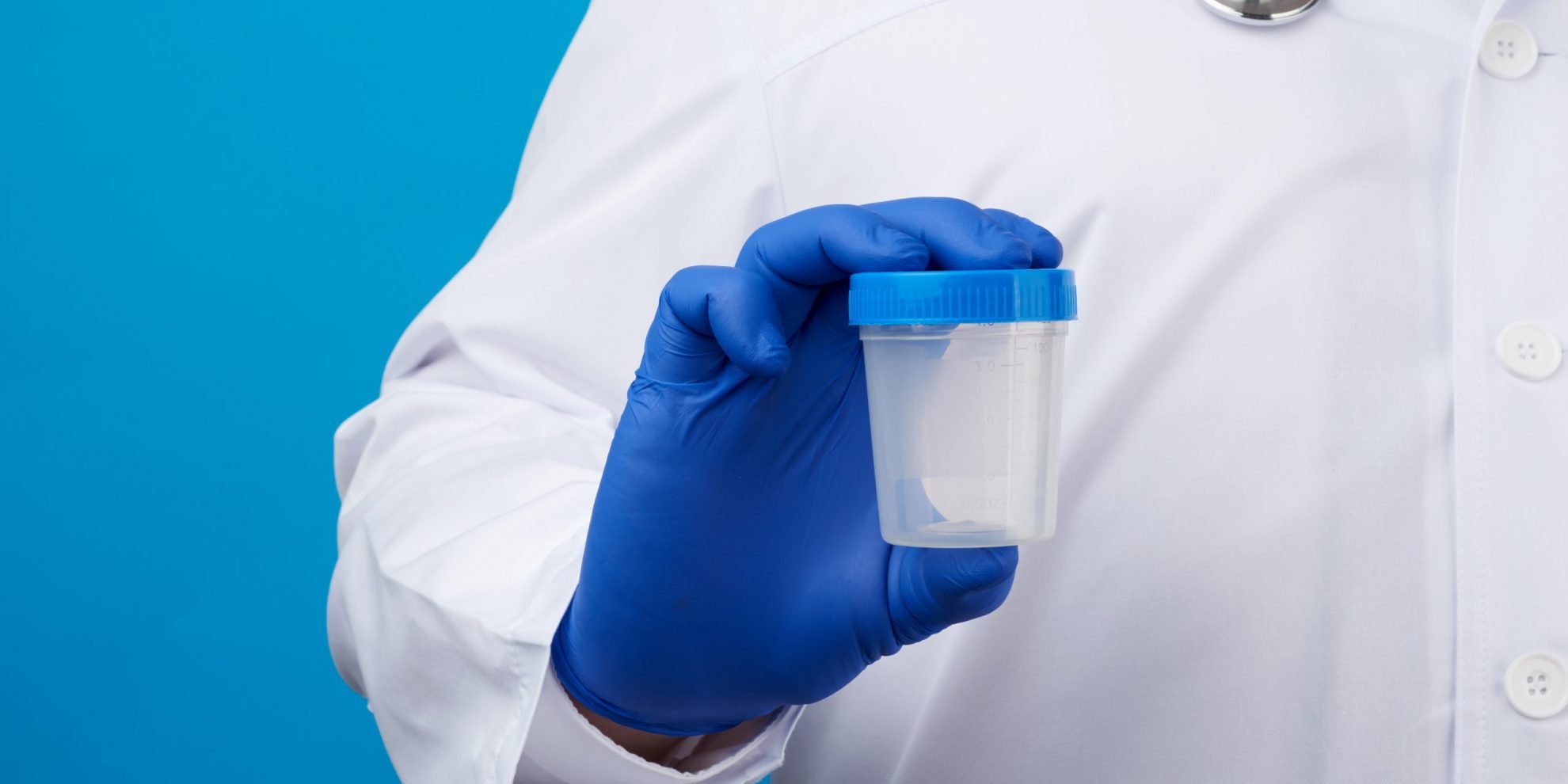 Photo of person in lab coat holding drug test cup.